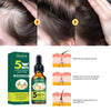 Eelhoe Ginger Hair Essential Oil for Hair Growth and Anti Hair Loss